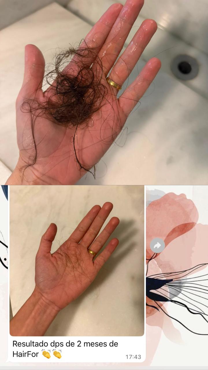 Relato de cliente HairFor+ 14