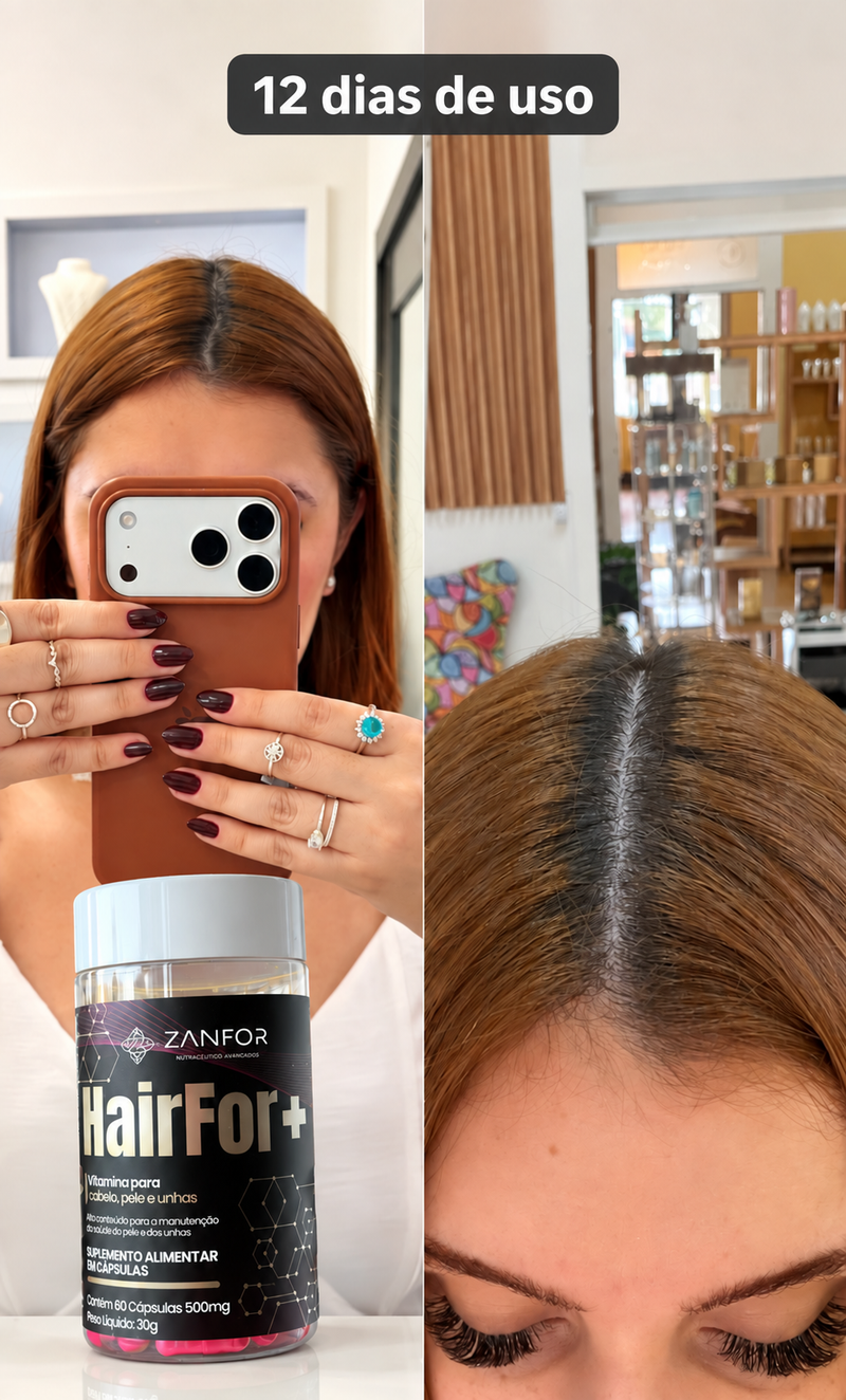 Relato HairFor+ 12 dias de uso