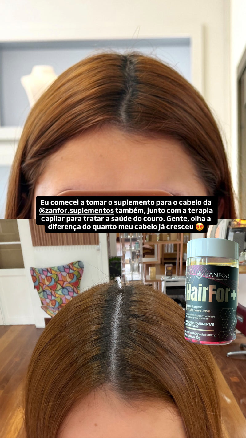 Relato HairFor+ crescimento